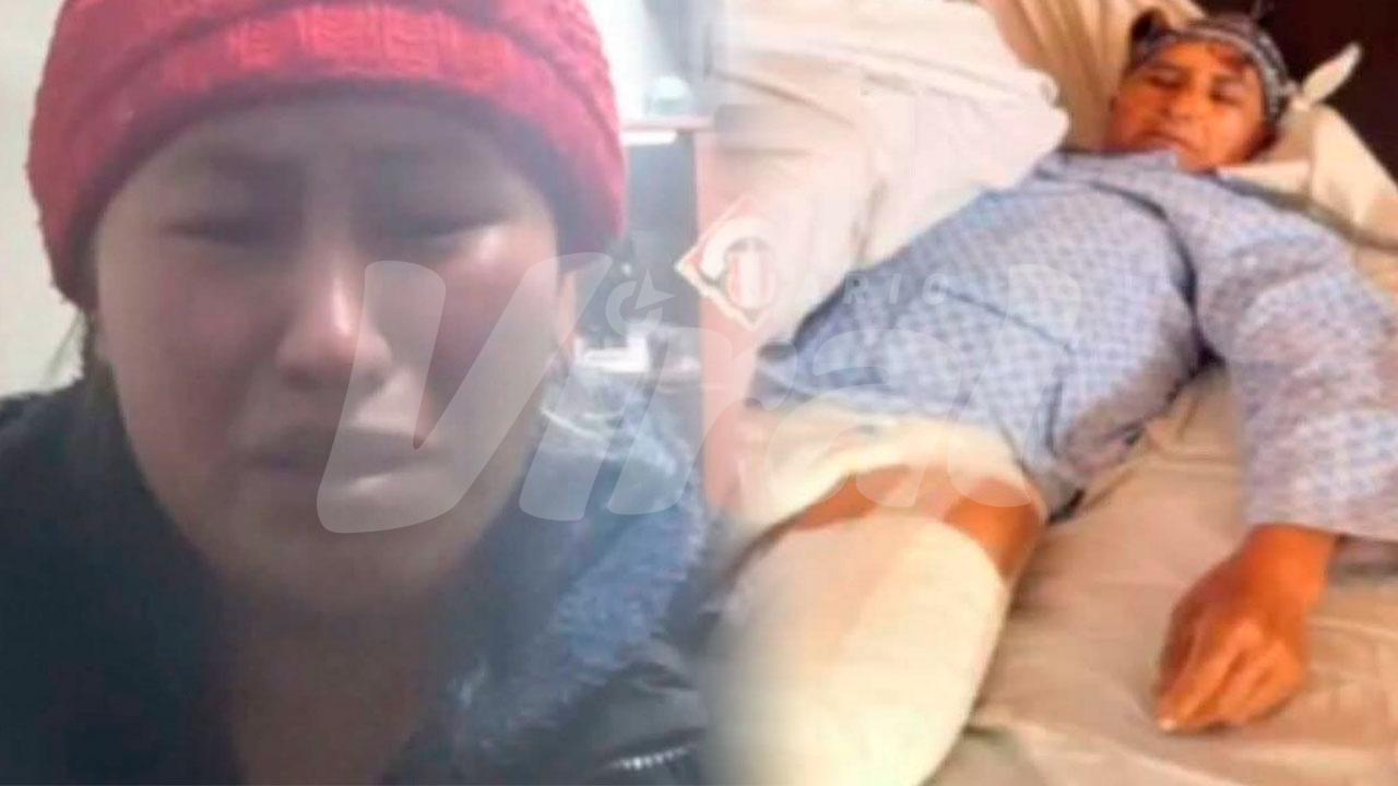 Mujer a prisión tras atropello en Puno