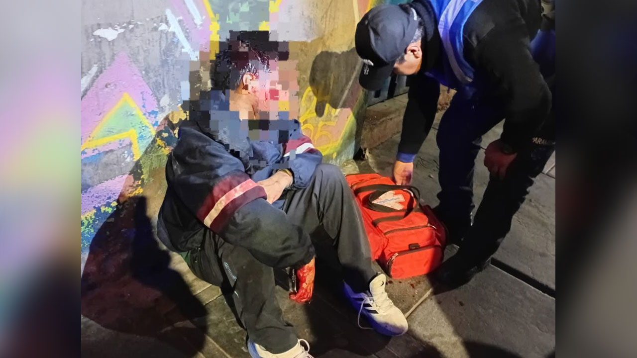 Arequipa: hallan a varón con cortes en el rostro y la mano