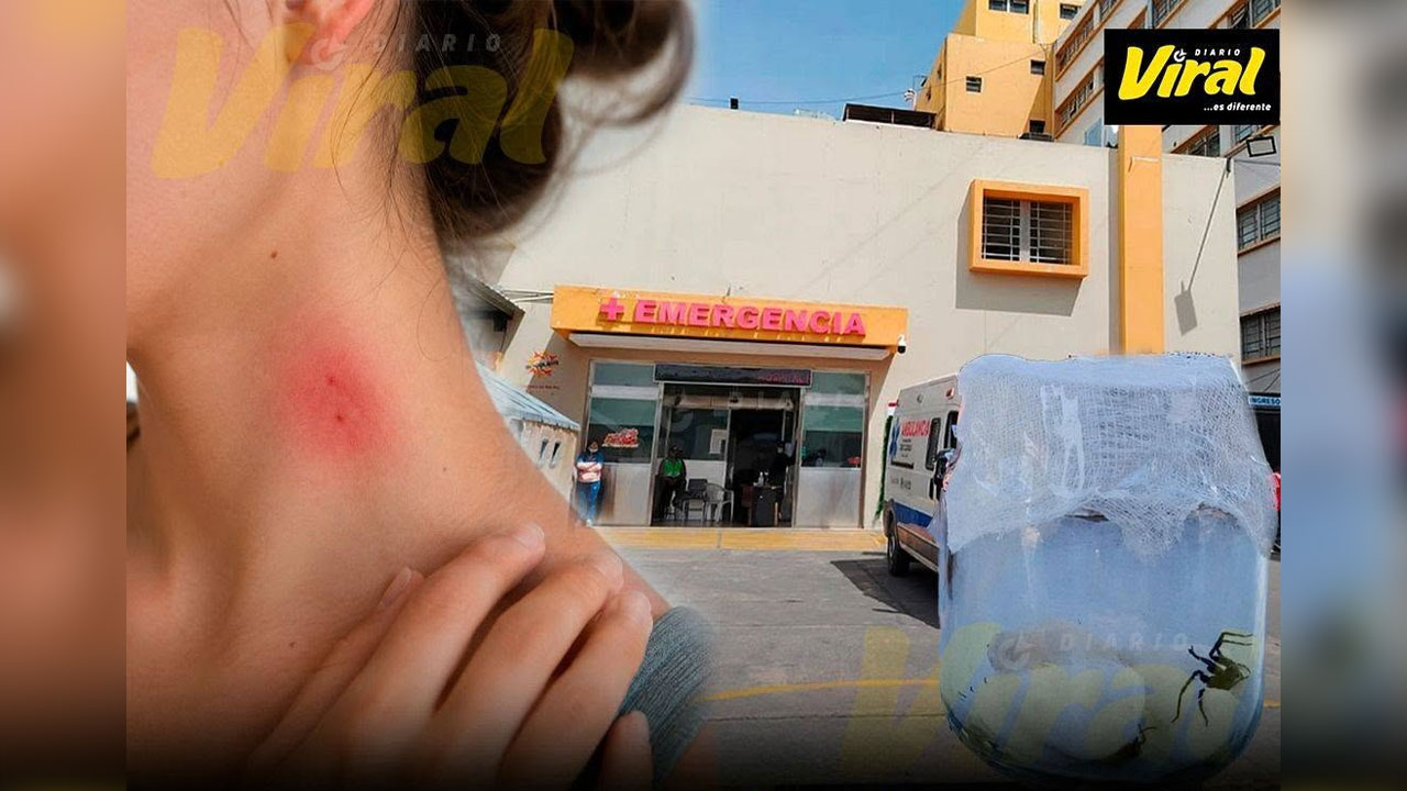 Caylloma: menor de 15 años muere tras picadura de araña
