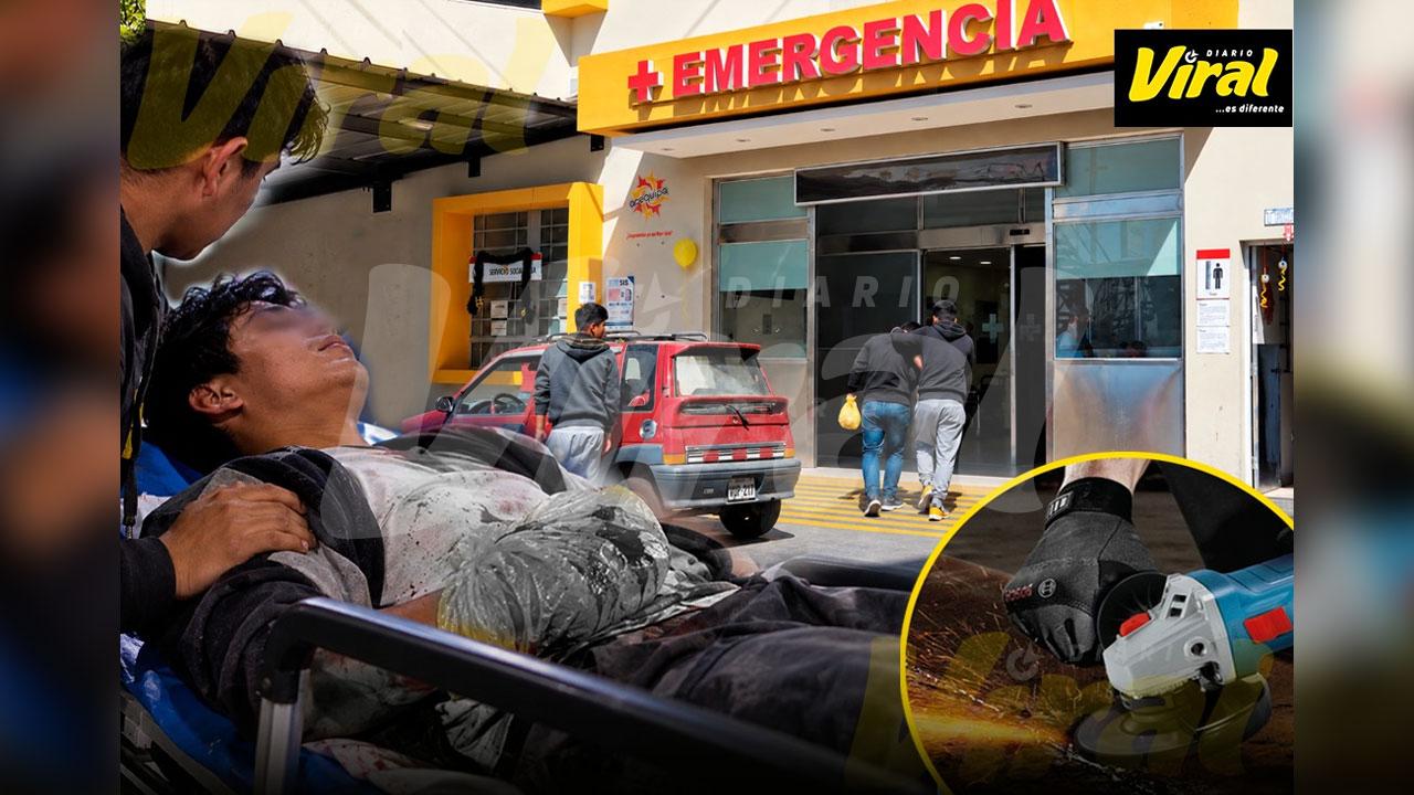 Arequipa: joven grave tras desangrarse por accidente con esmeril